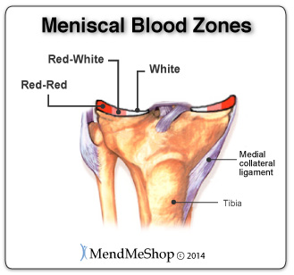 location of your torn meniscus matters for healing